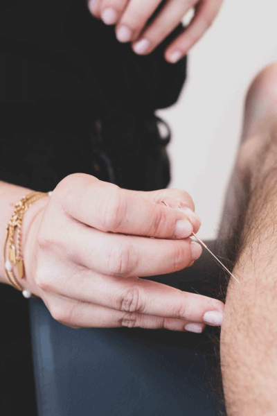 Dry needling  - sfeerbeeld 3